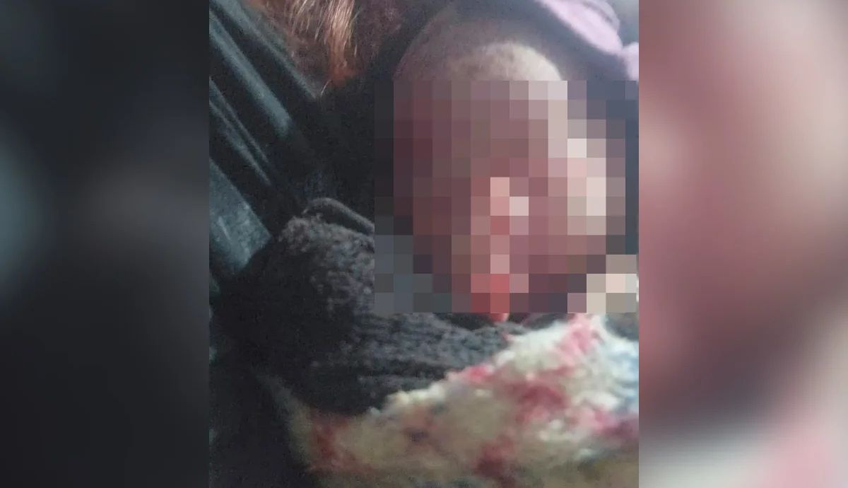 Bebê recém-nascida é encontrada dentro de sacola de lixo.