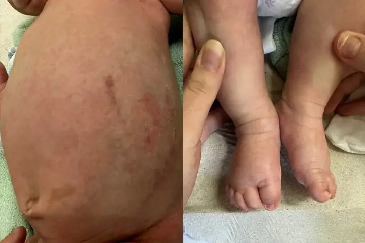 Pais são presos suspeitos de tentar matar filho de 40 dias.