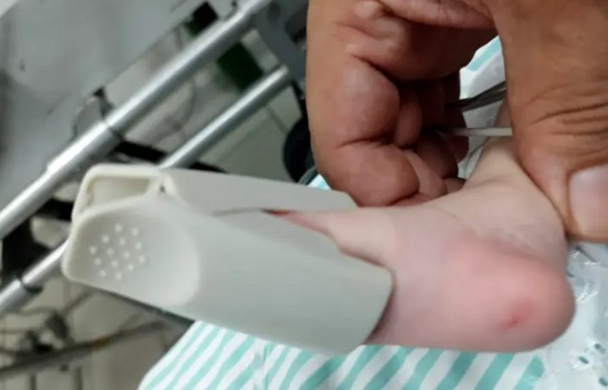 Recém-nascido agredido recebe alta hospitalar em Umuarama.